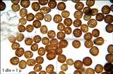 Sphacelotheca reiliana image