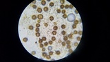 Scleroderma bovista image