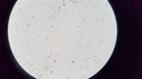 Limacella illinita image