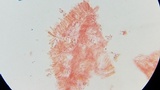 Limacella illinita image