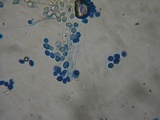 Postia ptychogaster image