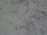 Postia ptychogaster image