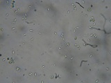 Postia ptychogaster image