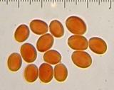 Leucoagaricus americanus image