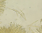 Lachnellula calyciformis image