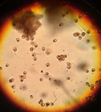 Calvatia pachyderma image