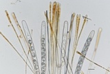 Scutellinia setosa image