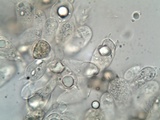 Inocybe rimosa image