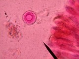 Lamprospora polytrichi image