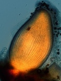Tolypocladium longisegmentatum image