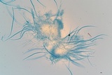 Tolypocladium longisegmentatum image