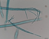 Tolypocladium longisegmentatum image
