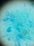 Nectria peziza image
