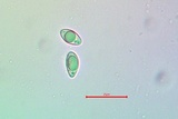 Lecanora circumborealis image
