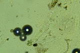 Nitschkia broomeana image