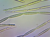 Tolypocladium longisegmentatum image