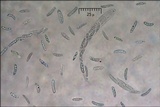 Eutypella quaternata image