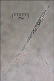 Eutypella quaternata image