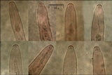 Eutypella quaternata image
