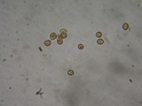 Cortinarius infractus image