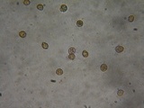 Cortinarius infractus image