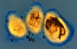 Cordyceps tuberculata image