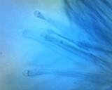 Cordyceps tuberculata image