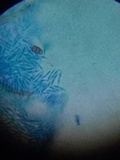 Pseudolachnea hispidula image