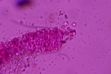 Radulomyces confluens image