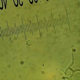 Ripartitella brasiliensis image