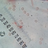 Hydnum zongolicense image