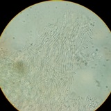 Cyphellostereum pusiolum image