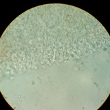 Cyphellostereum pusiolum image
