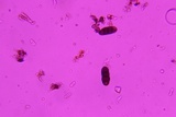 Rhytidhysteron rufulum image