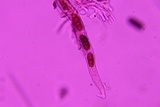 Rhytidhysteron rufulum image