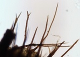 Scutellinia erinaceus image