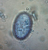Scutellinia erinaceus image