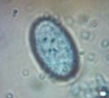 Scutellinia erinaceus image