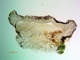 Catillaria glauconigrans image