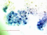 Catillaria glauconigrans image