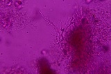Eichleriella macrospora image