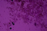 Eichleriella macrospora image