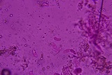 Eichleriella macrospora image