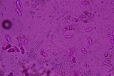 Eichleriella macrospora image