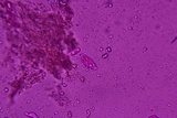 Eichleriella macrospora image