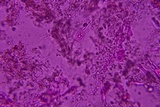 Eichleriella macrospora image