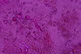 Eichleriella macrospora image