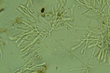 Cylindrobasidium evolvens image