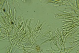 Cylindrobasidium evolvens image