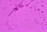 Pseudonectria buxi image